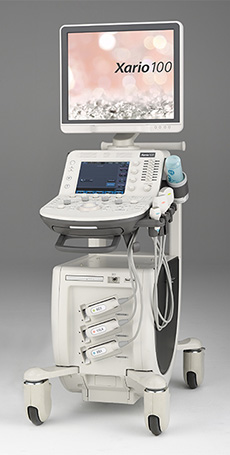 超音波診断装置 Xario™ Platinum Series